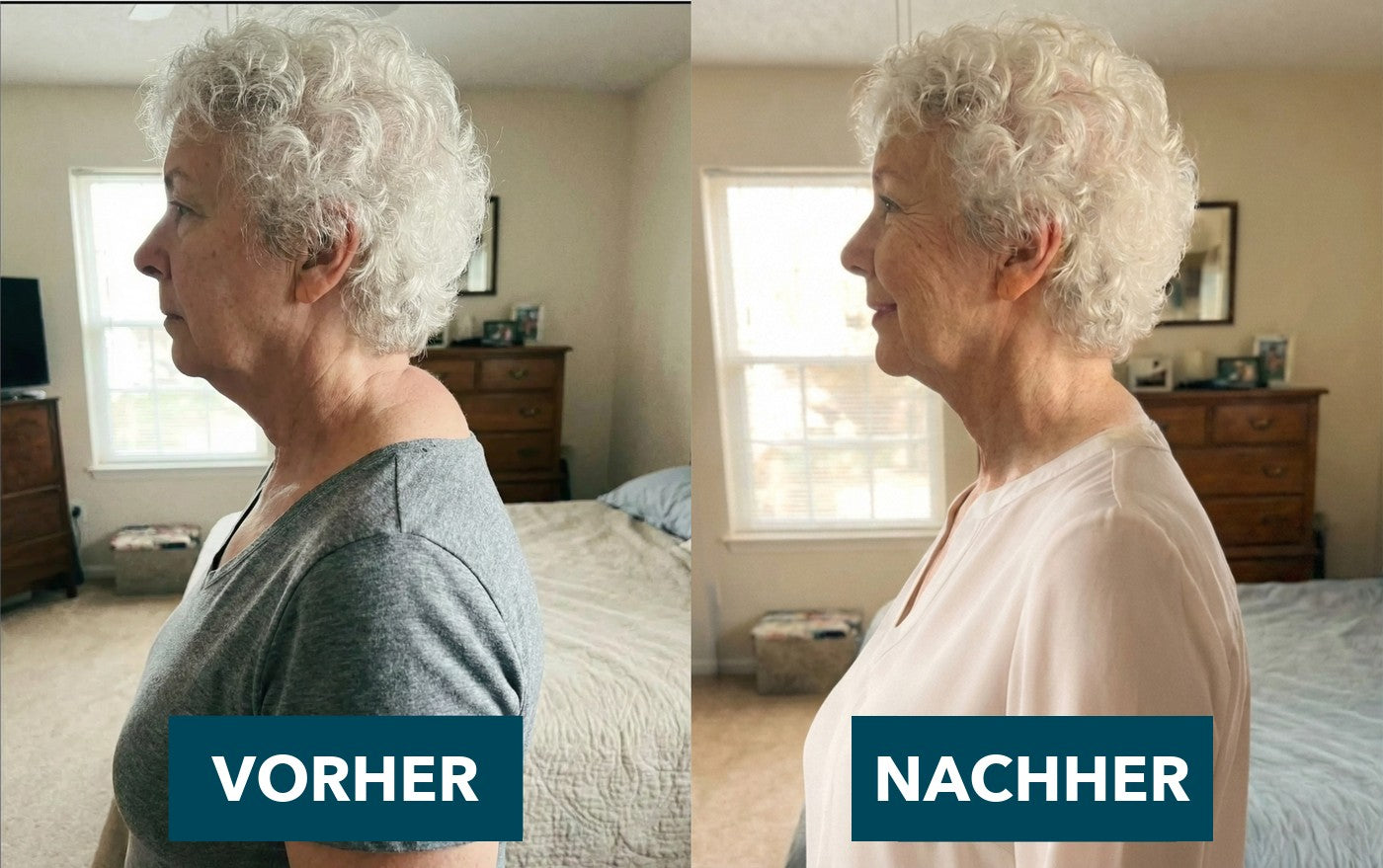 Vorher und nachher